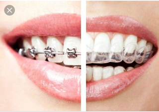 Manufacturers of invisible braces and smile design solutions using advanced software.